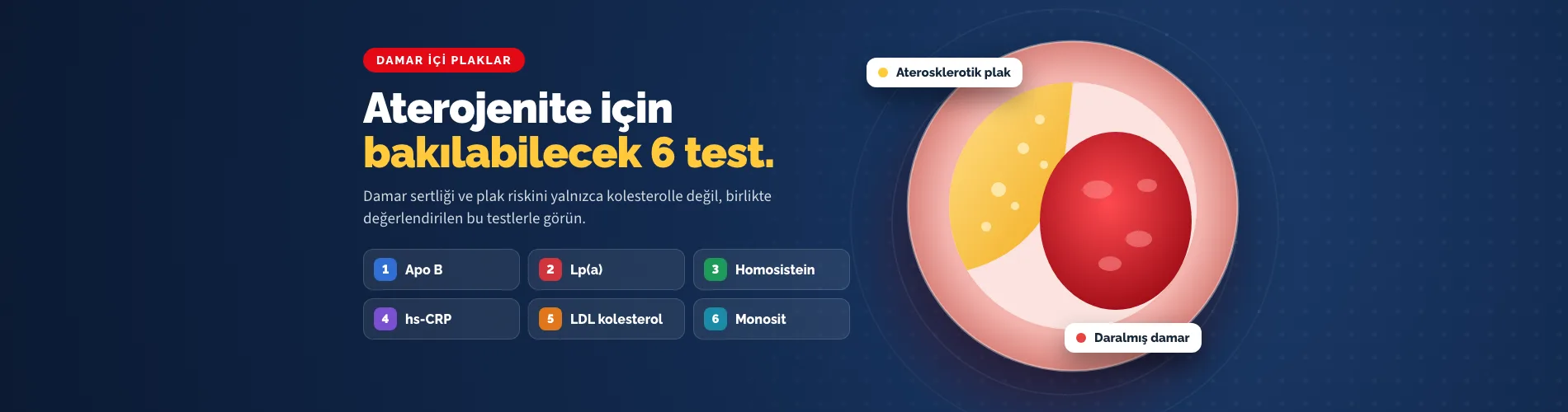 Damar içi plaklar: aterojenite için bakılabilecek 6 test (Apo B, Lp(a), homosistein, hs-CRP, LDL kolesterol, monosit)